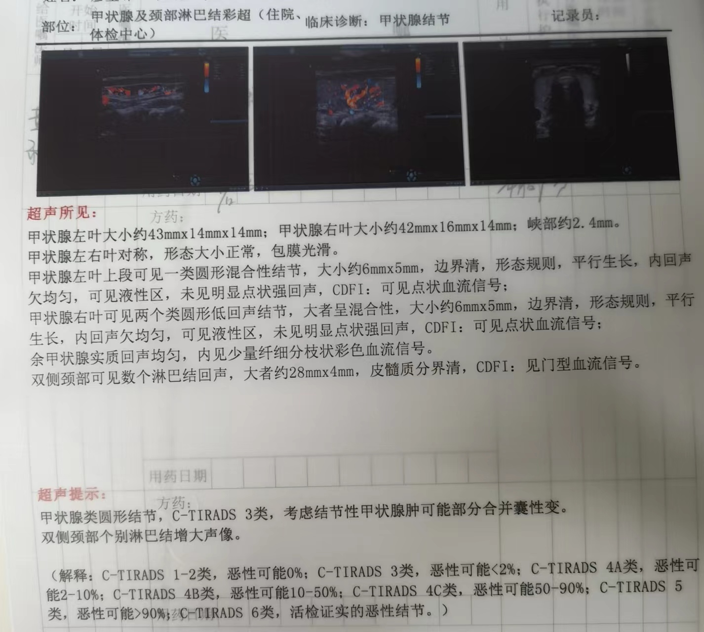 华容县人民医院超声科开展首例甲状腺细针穿刺术