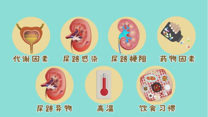 “难言之痛”——带您走进泌尿系结石的世界 - 广东省中医院海南医院(海南省中医院、海南省中西医结合医院、海南省中医药研究院)